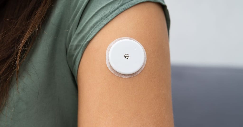 close up of arm fitted with continuous glucose monitor