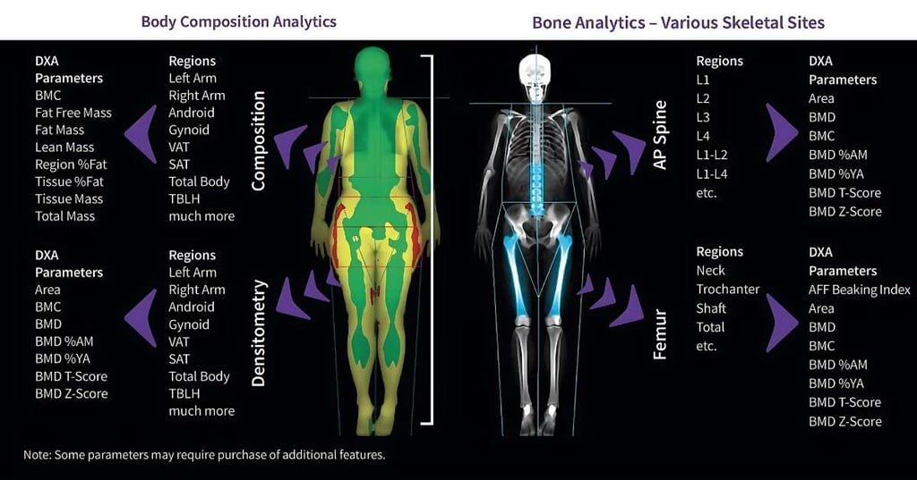 screenshot of body composition analytics bone analytics dexa scan results